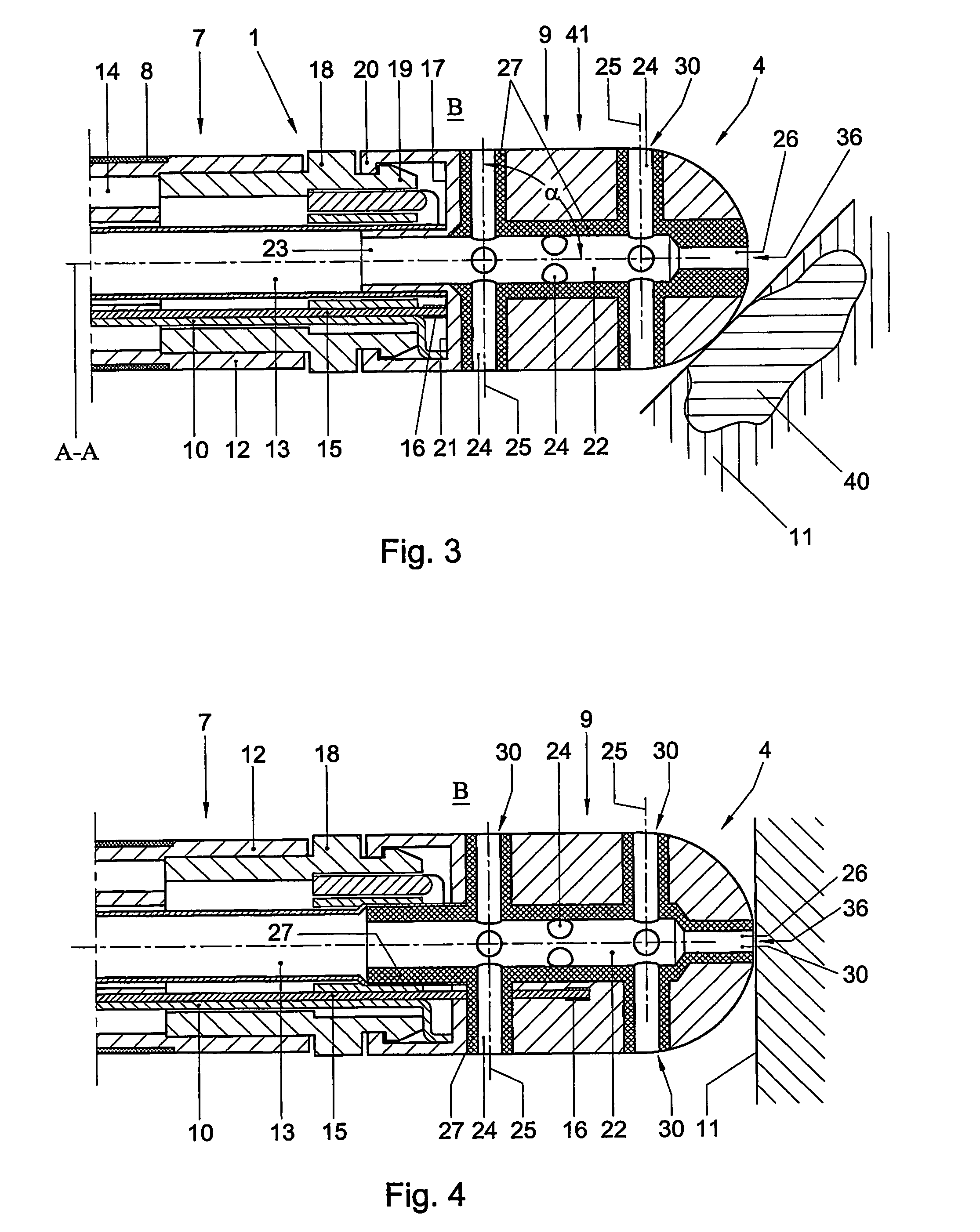 Catheter and method, in particular for ablation and like technique