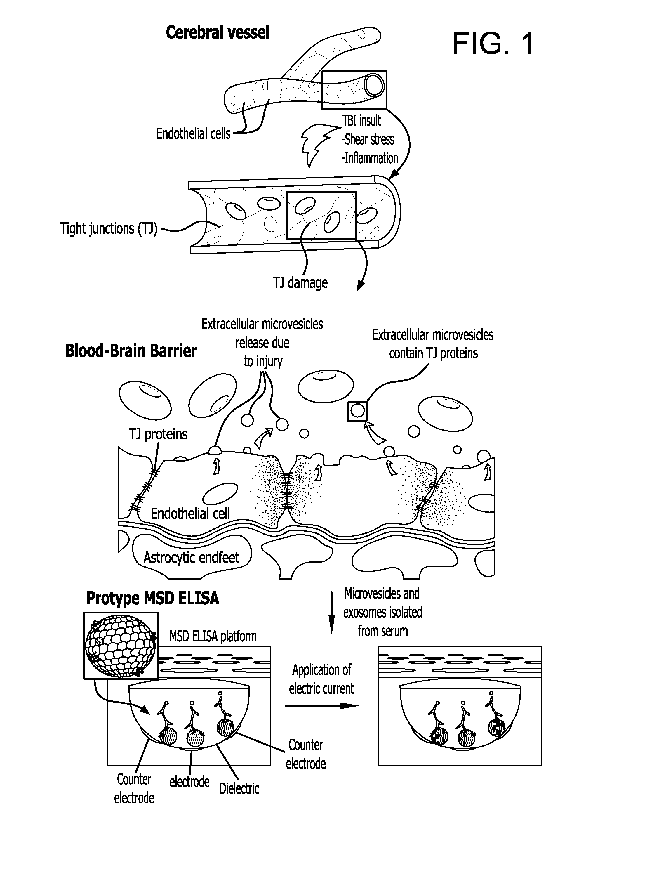 Method for detecting injury to the brain