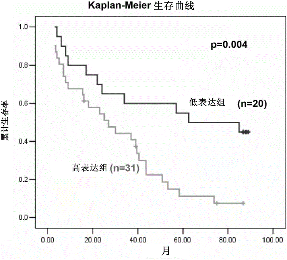 Application of SSX2IP in predicating or diagnosing tumor metastasis