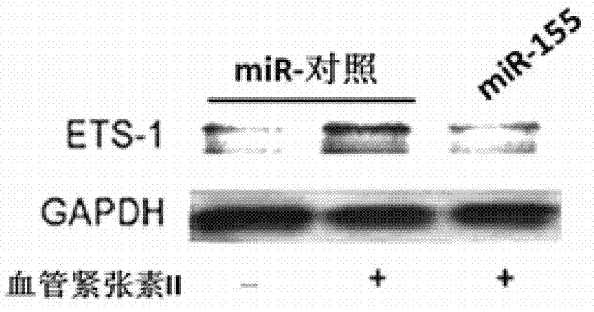 miRNA applied method for inhibiting migration of endothelial cell