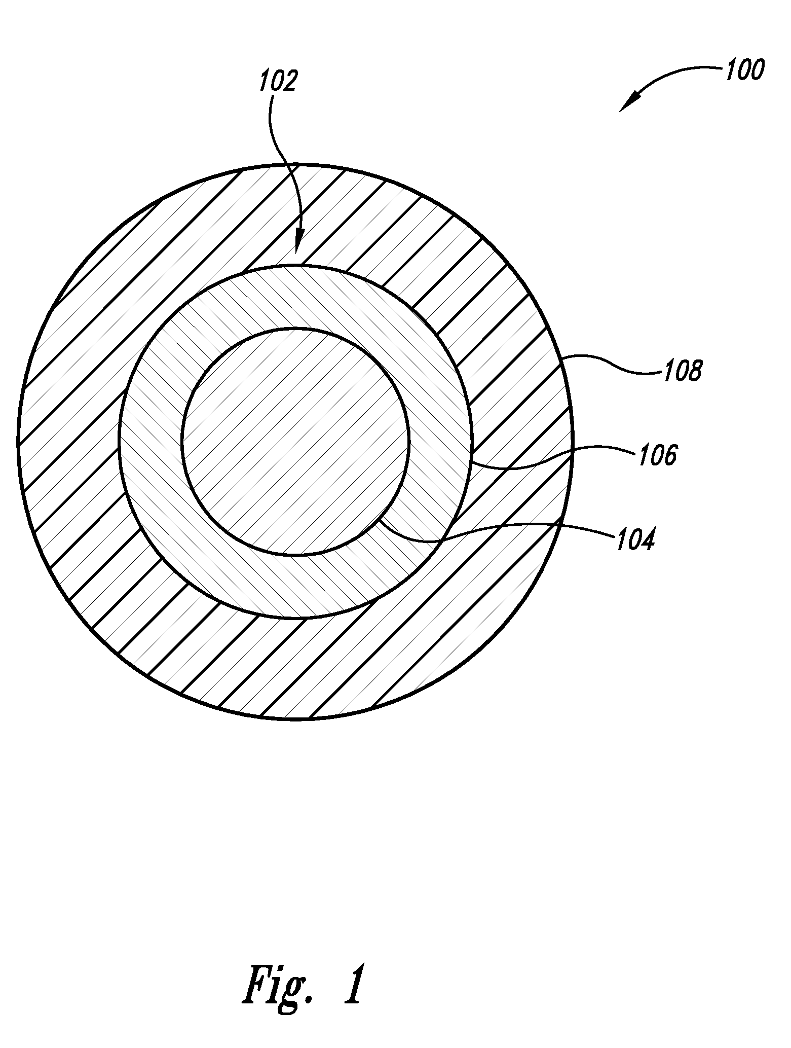 Enhanced implantable loop antenna system and method