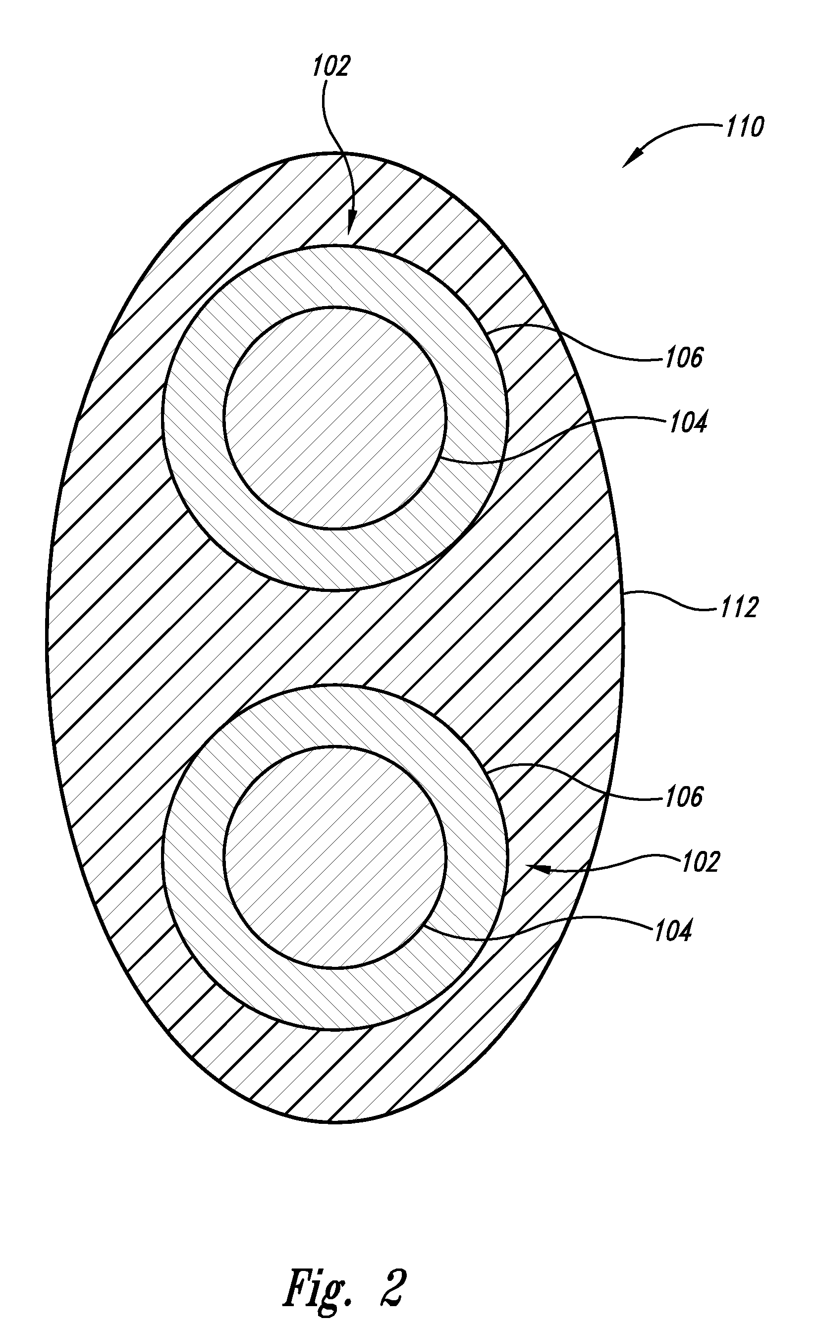 Enhanced implantable loop antenna system and method