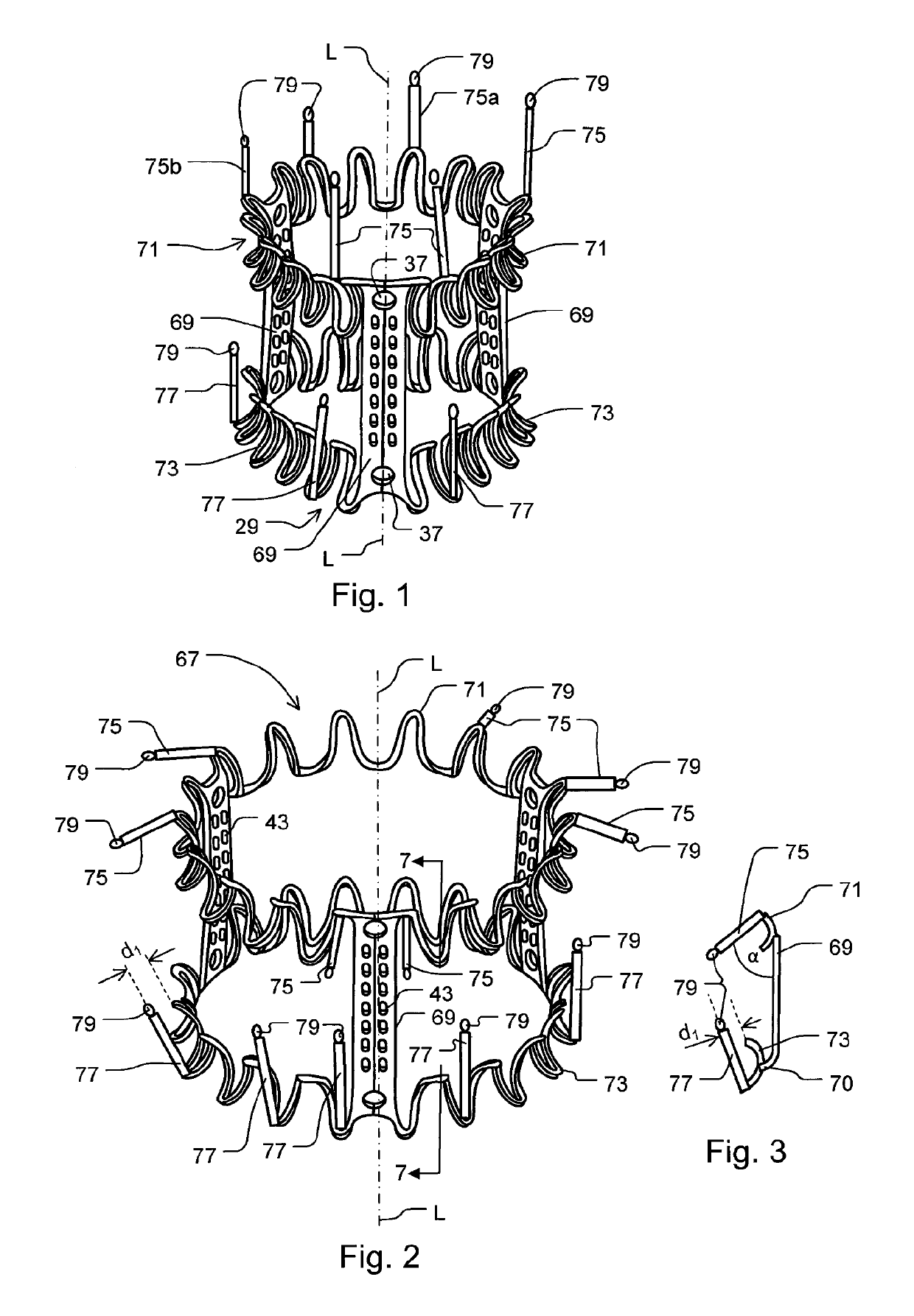 Minimally invasive mitral valve replacement with brim