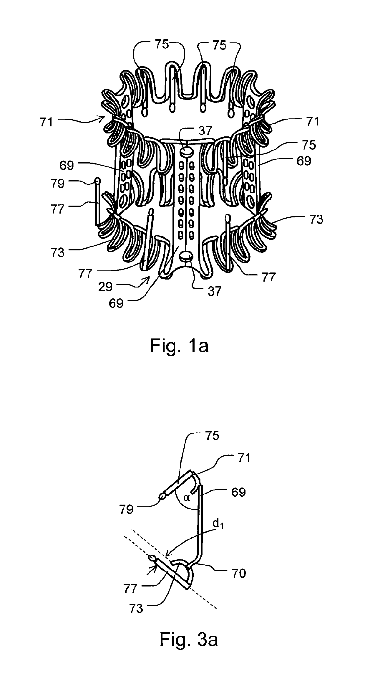 Minimally invasive mitral valve replacement with brim