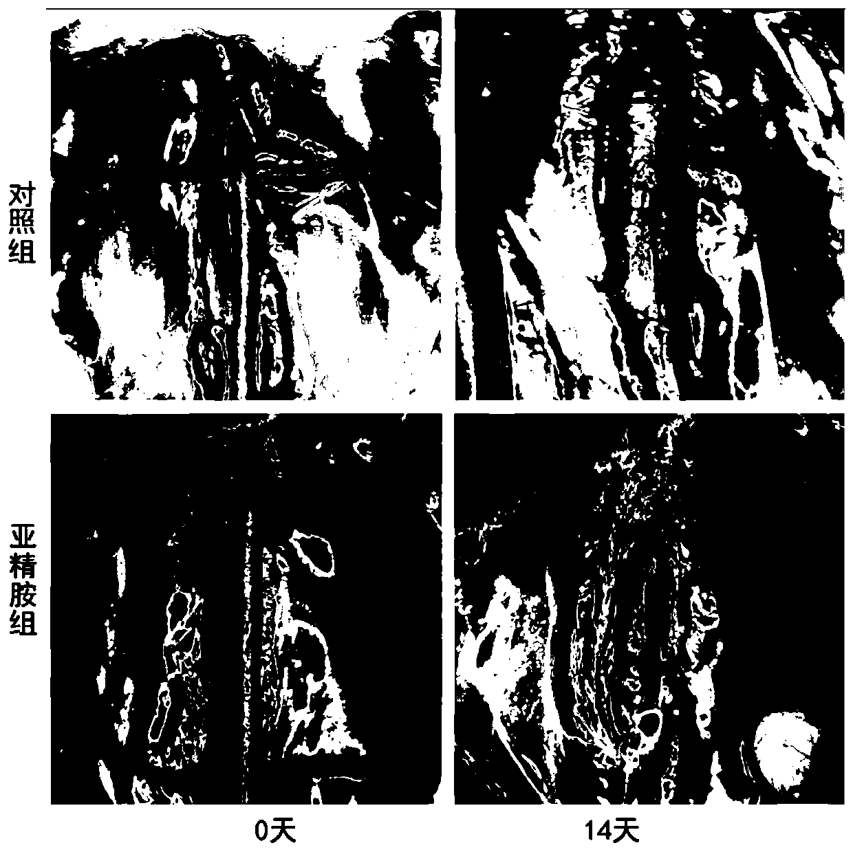 Application of spermidine in preparation of aortic aneurysm treatment drug