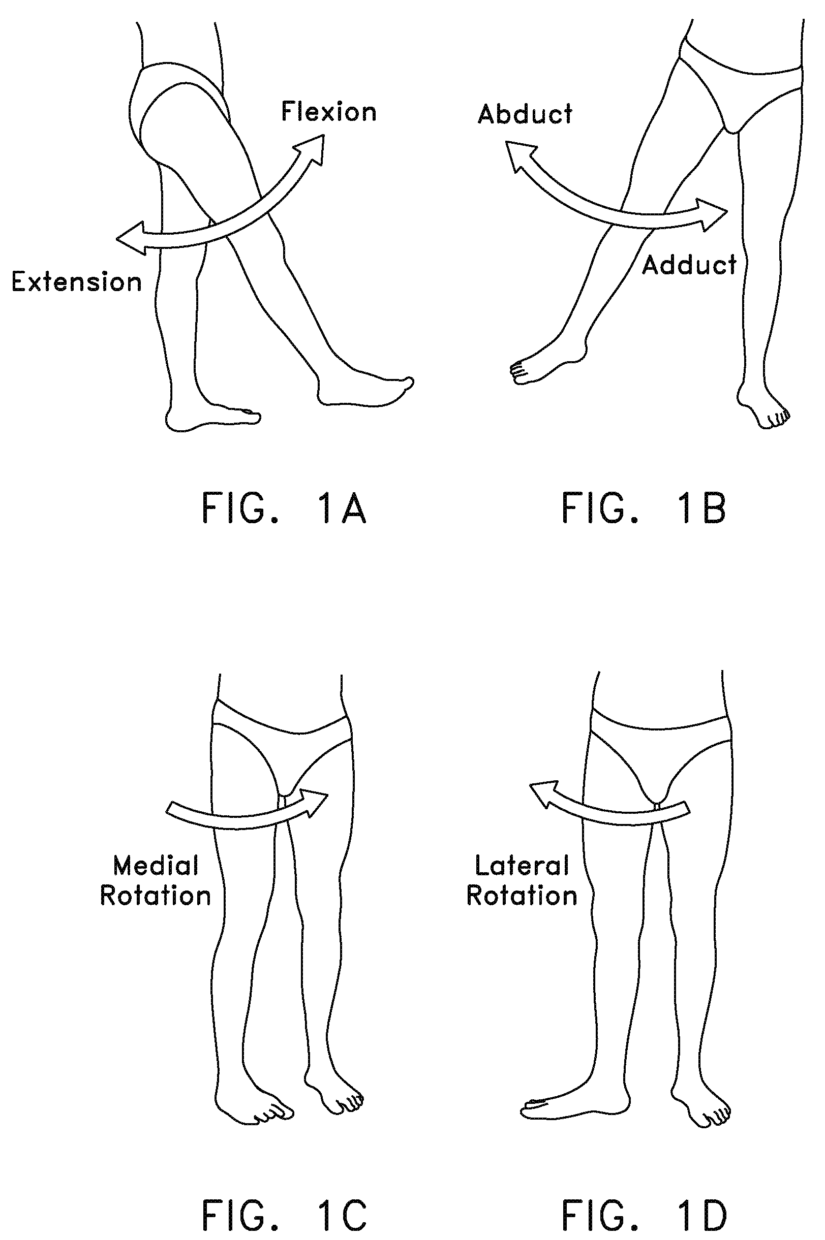 Method and apparatus for distracting a joint, including the provision and use of a novel fluid joint spacer