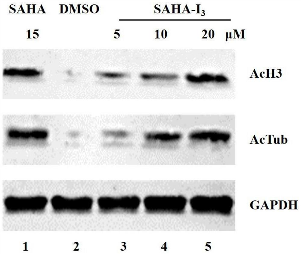 Diagnosis and treatment integrated compound as well as preparation method and application thereof