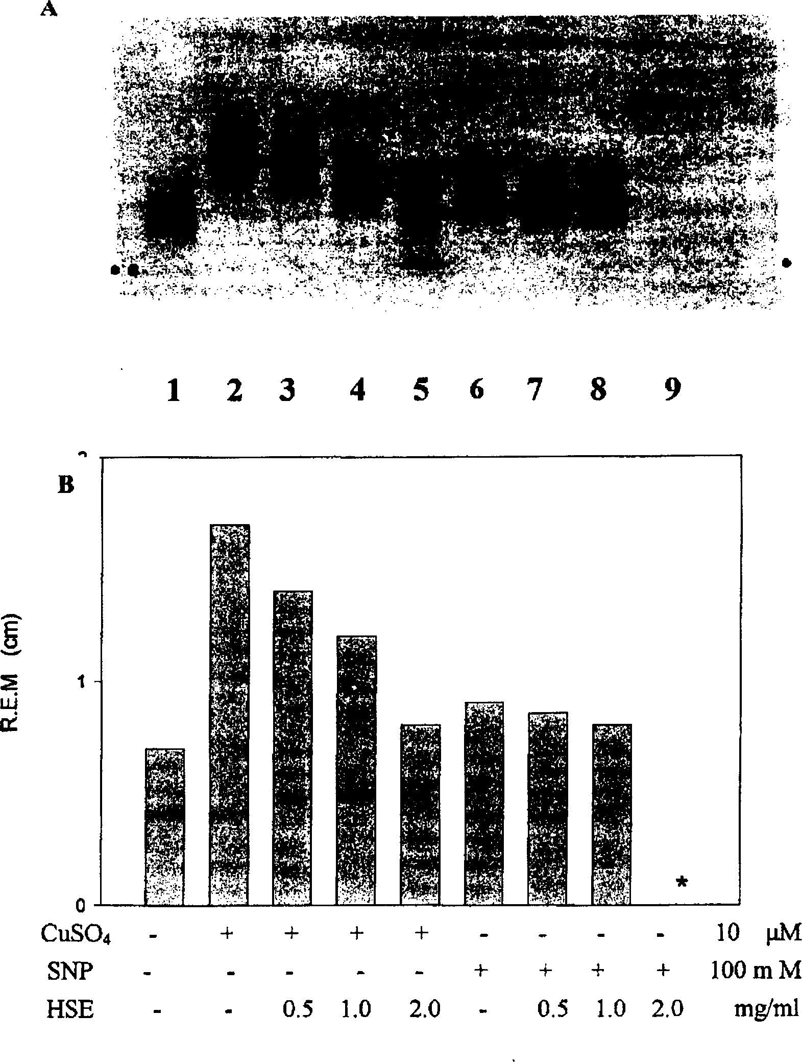 Application of Hibiscus sabdariffa Linn extractive in preparing medicine for inhibiting cardiac and cerebral vascular diseases