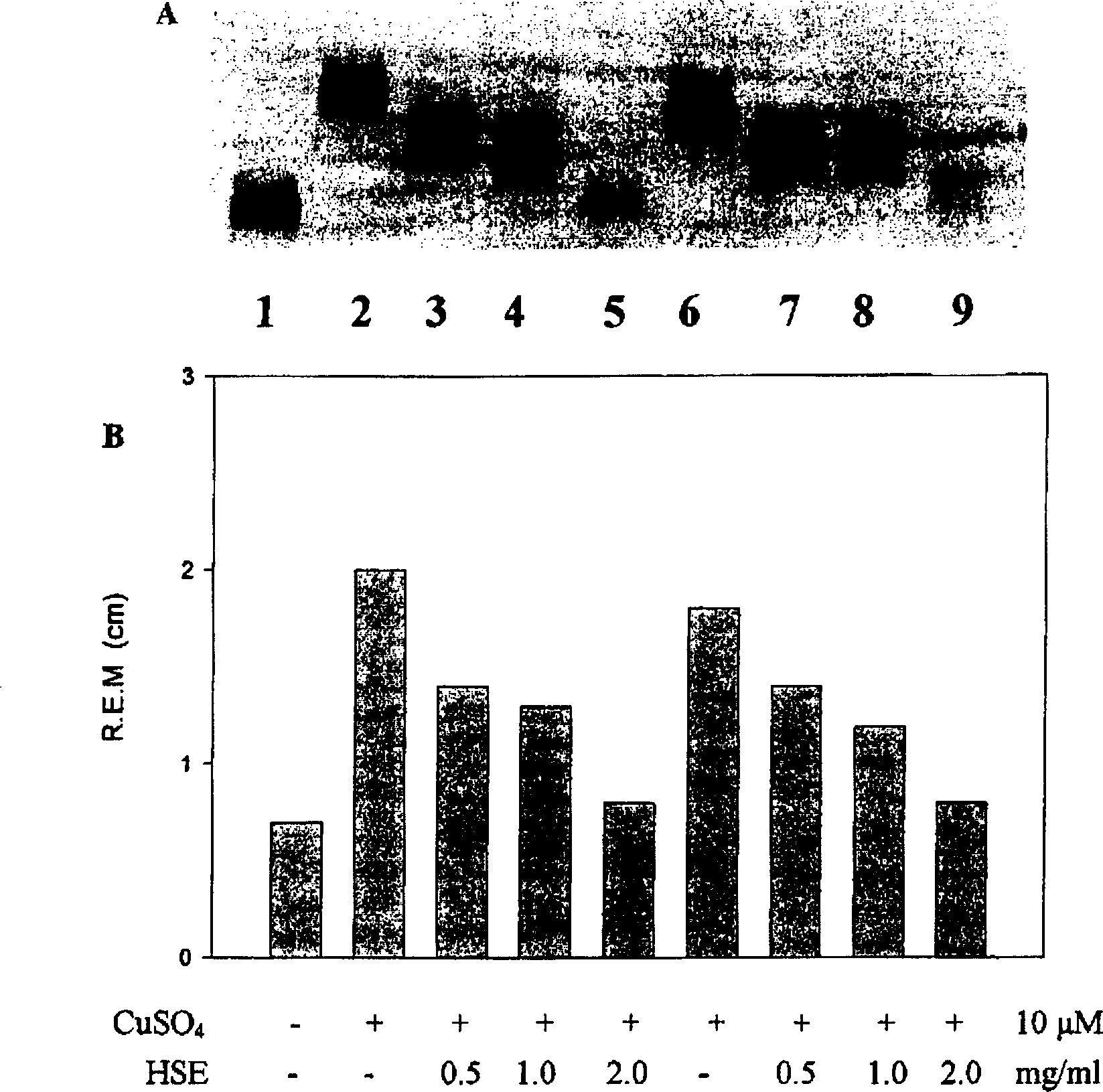 Application of Hibiscus sabdariffa Linn extractive in preparing medicine for inhibiting cardiac and cerebral vascular diseases