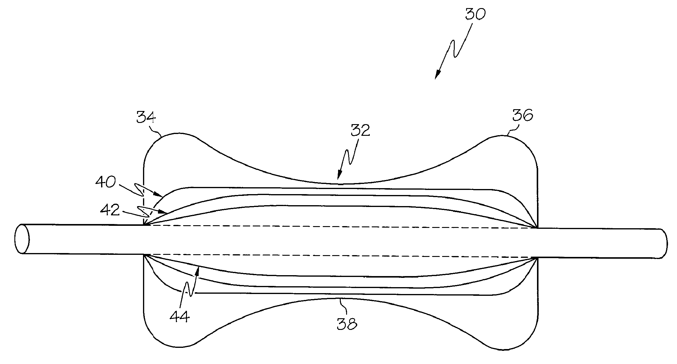 Airway Balloon Dilator