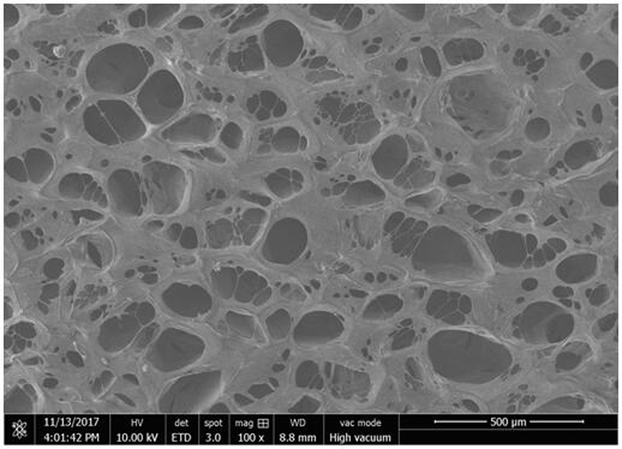 A kind of preparation method and product thereof with sustained-release antibacterial dressing