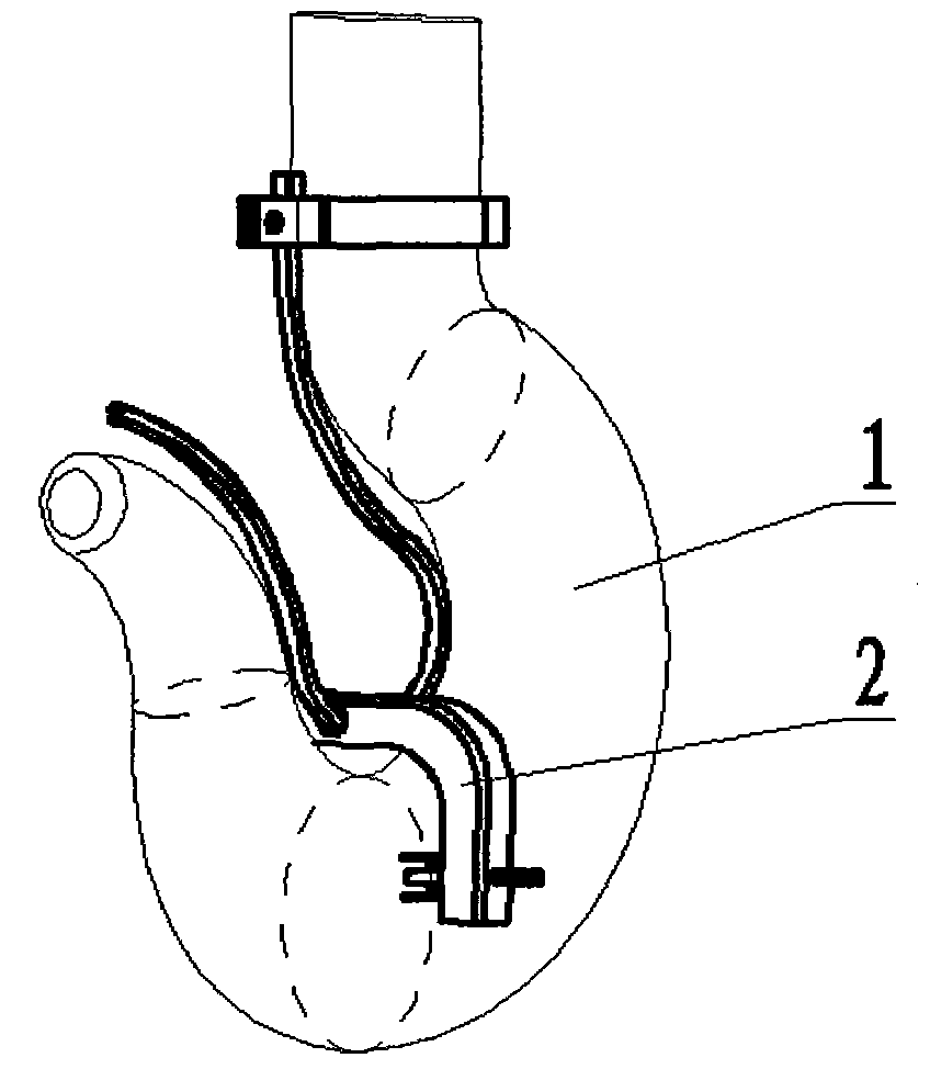 Detection device and detection method of torsional deformation of hoisting hook