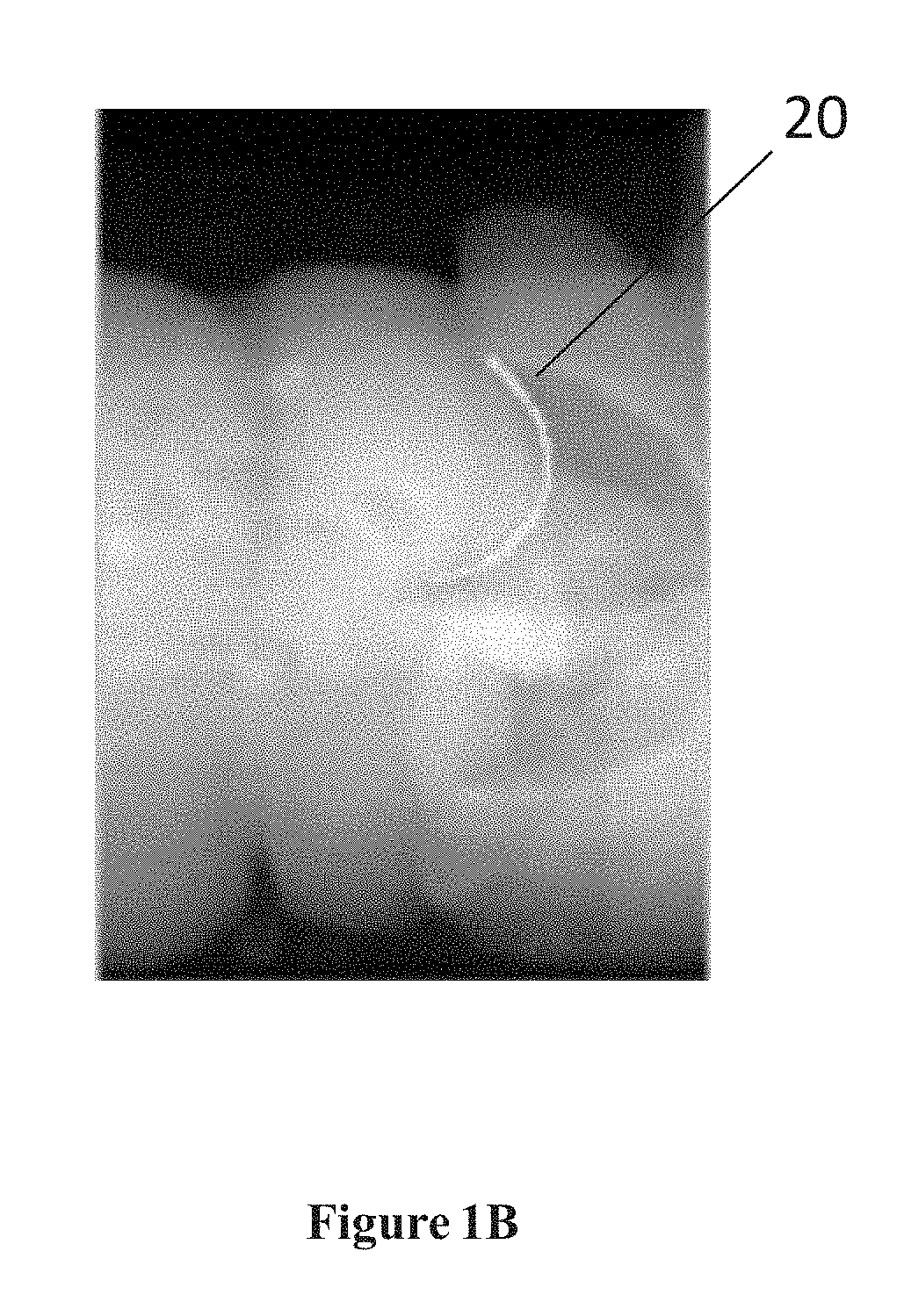 Method for Fiducialless Real-time Tracking in Radiation Treatment of Abdominal Tumors