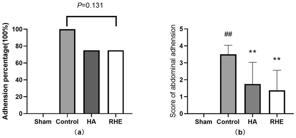 Medicine for treating postoperative abdominal adhesion, and new use of medicine