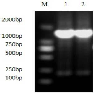 Fusion protein of cytoglobin and sipunculus nudus plasmin