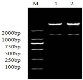 Fusion protein of cytoglobin and sipunculus nudus plasmin