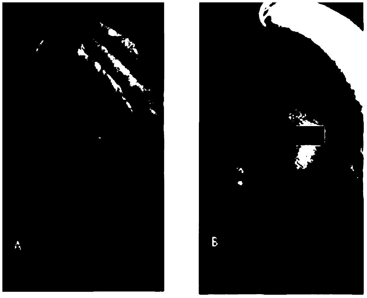 Pharmaceutical composition for treating scars on the skin, and method for treating scars on the skin using same