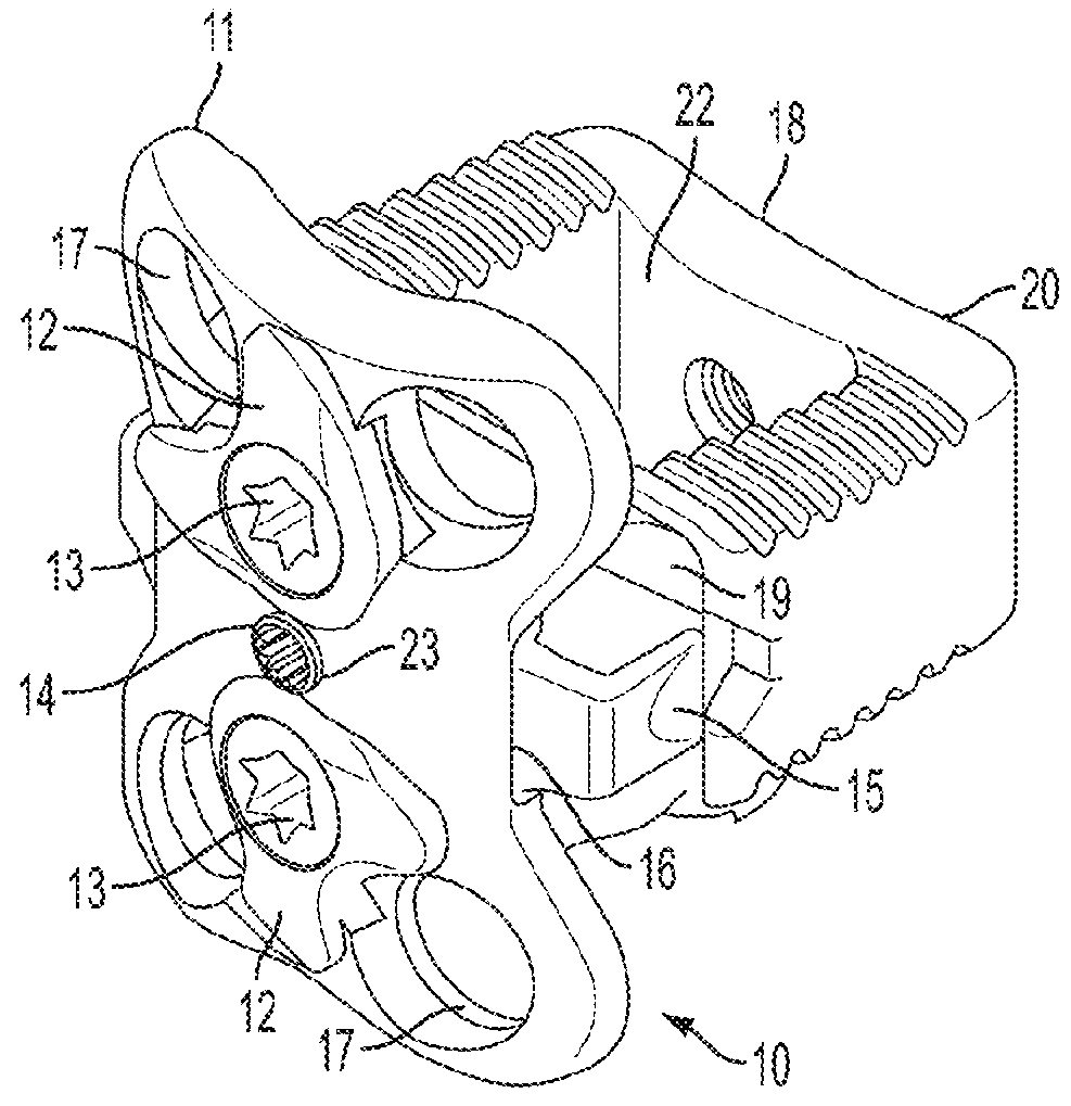 Cervical implant with exterior face plate