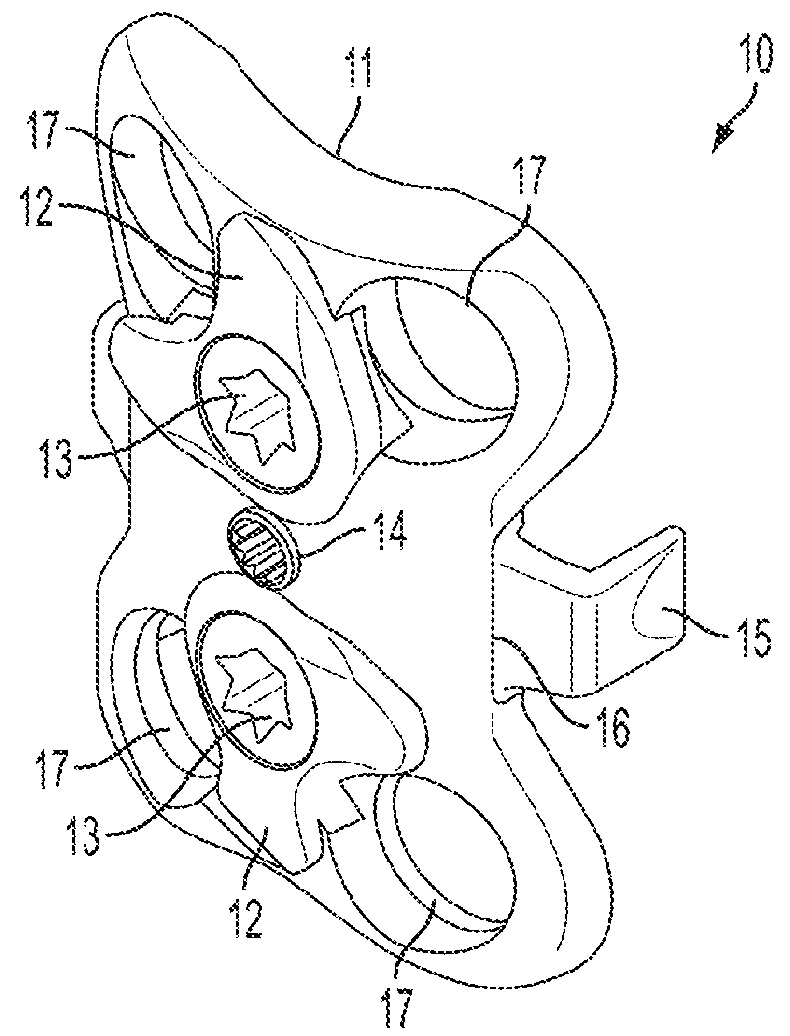 Cervical implant with exterior face plate