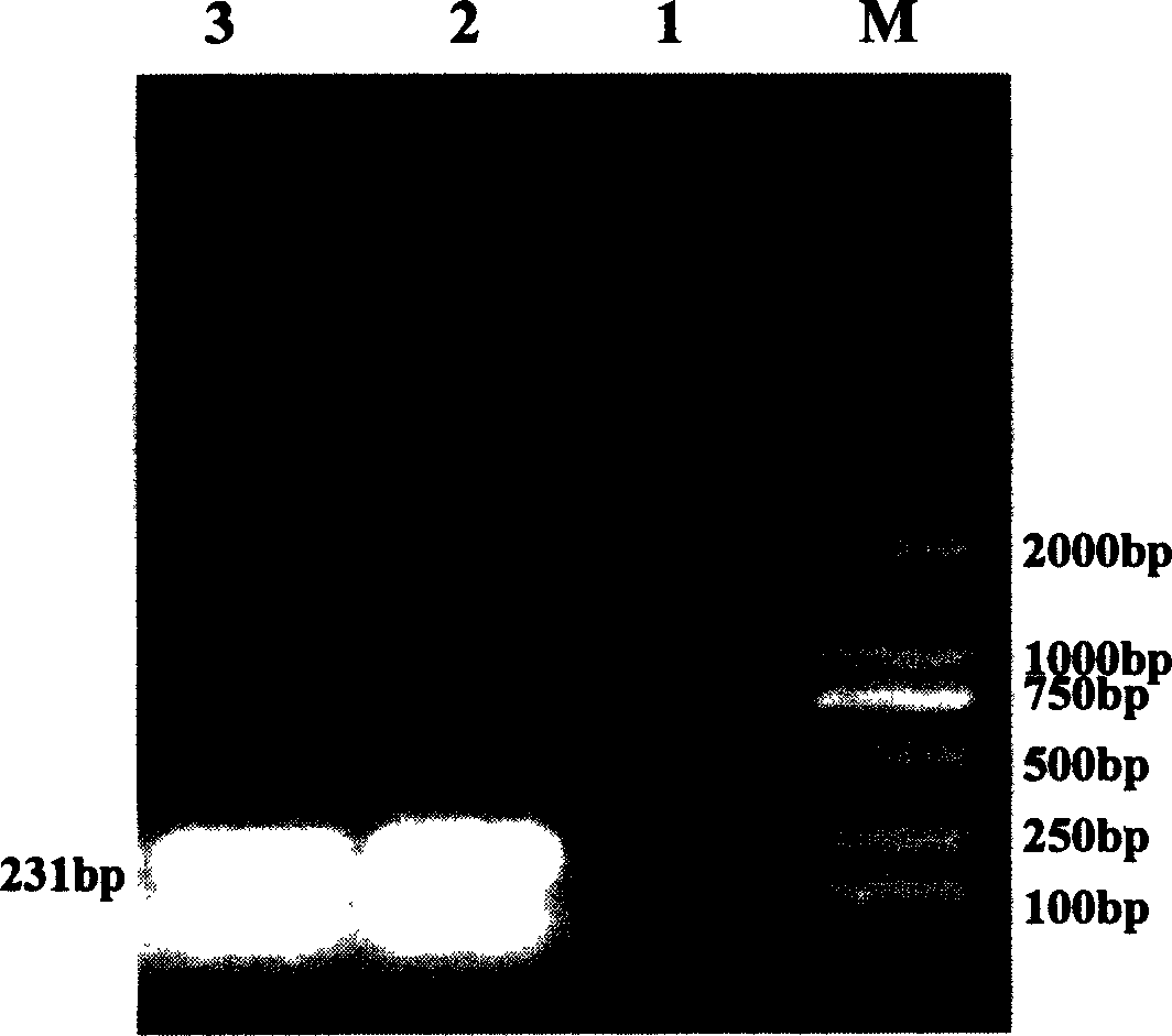 Prawn taura syndrome virogene diagnostic kit and detecting method