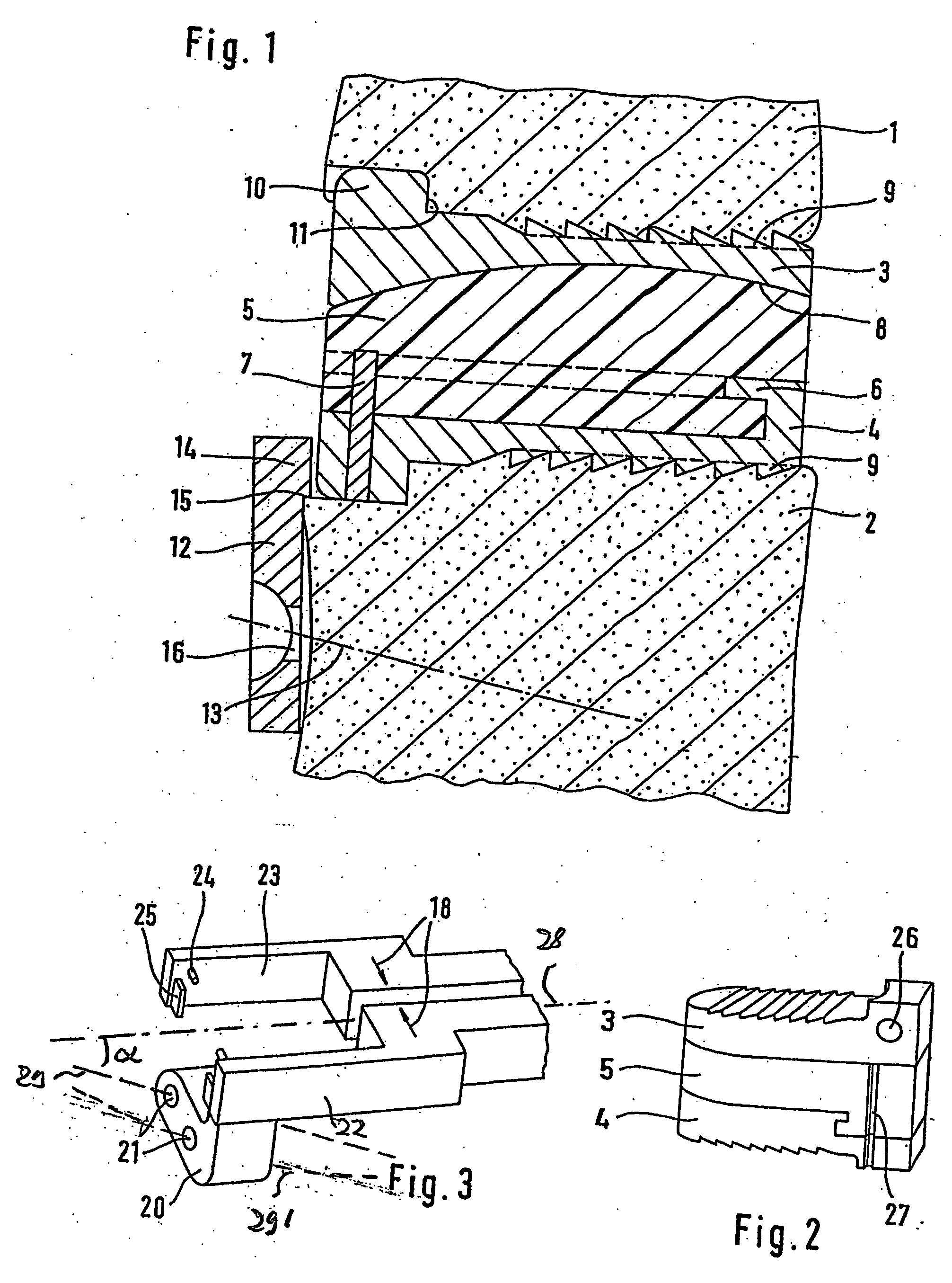 Cervical intervertebral prosthesis