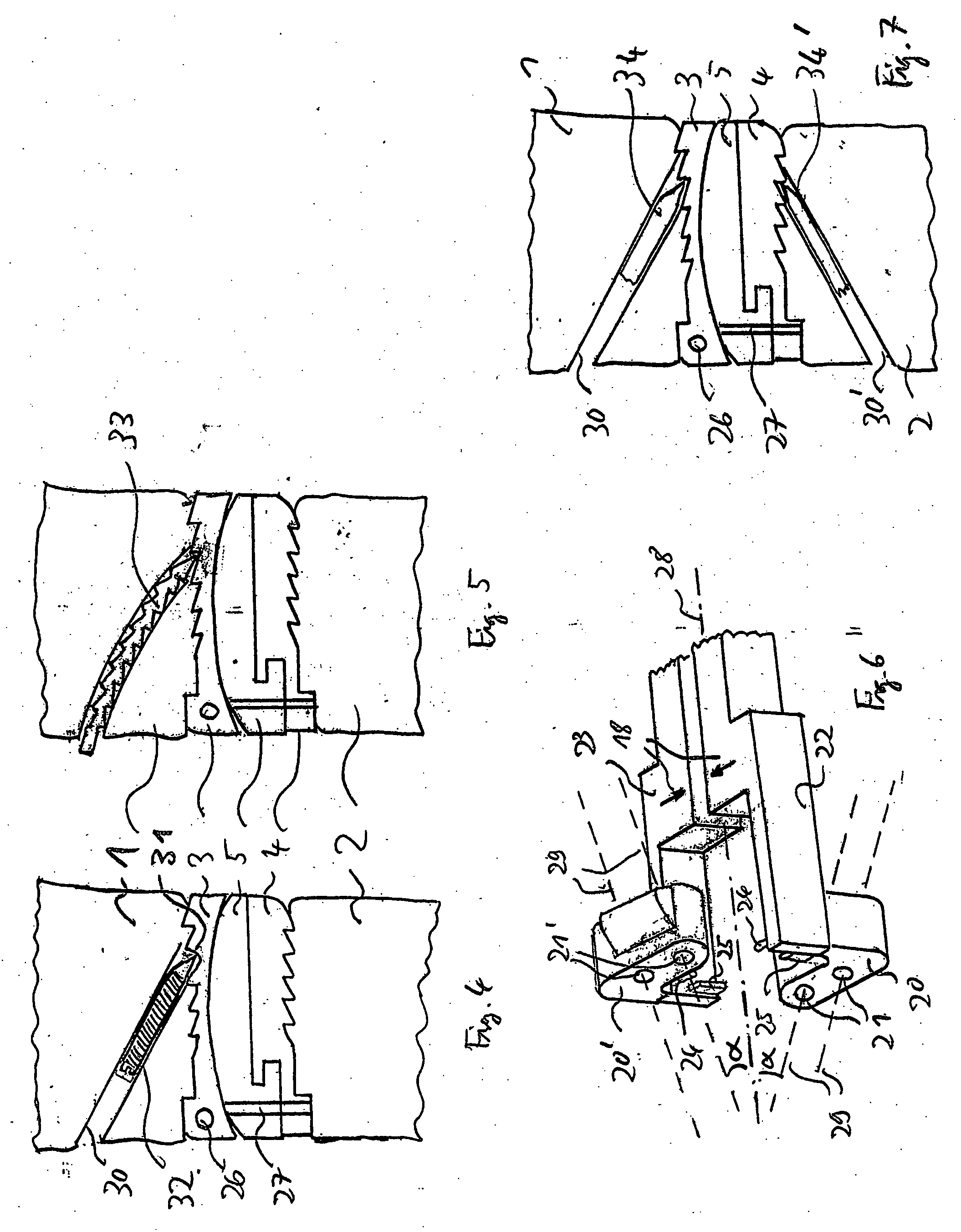 Cervical intervertebral prosthesis