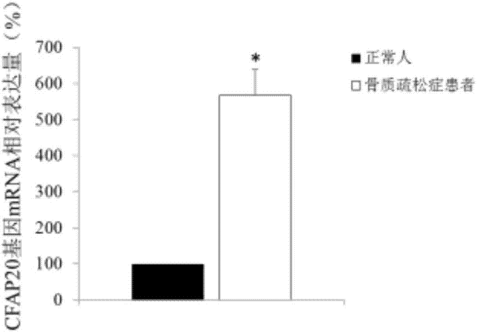 Application of CFAP20 gene in diagnosis of osteoporosis