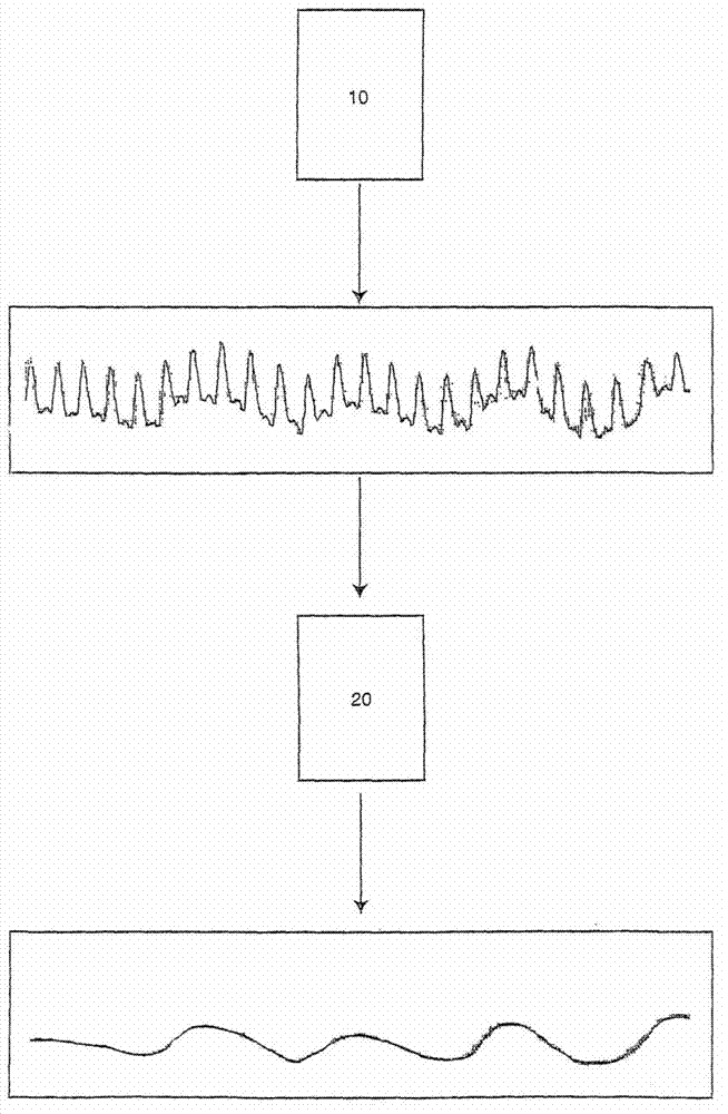 Method and apparatus for non-invasive monitoring of respiratory parameters in sleep disordered breathing