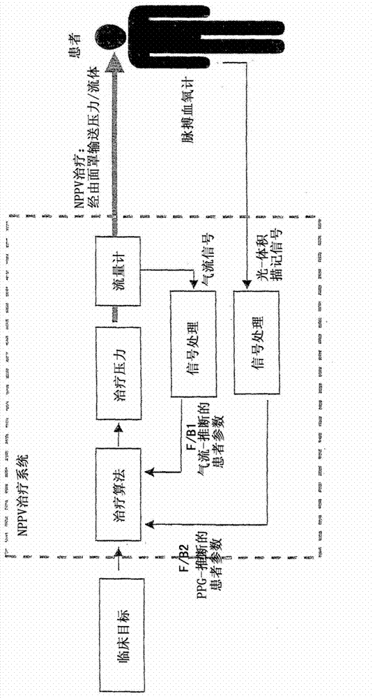 Method and apparatus for non-invasive monitoring of respiratory parameters in sleep disordered breathing