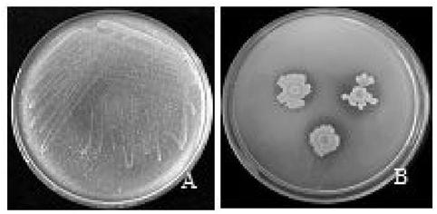 Forest tree rhizosphere bacteria Bacillus paramycoides JYZ-SD5 and application thereof