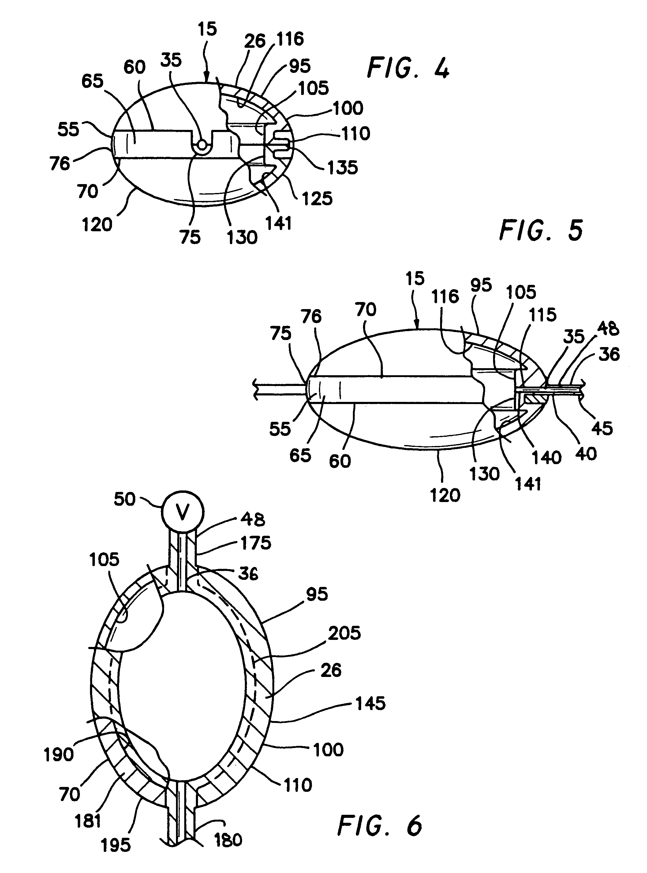 Ovoid flexible pressure vessel, apparatus and method for making same