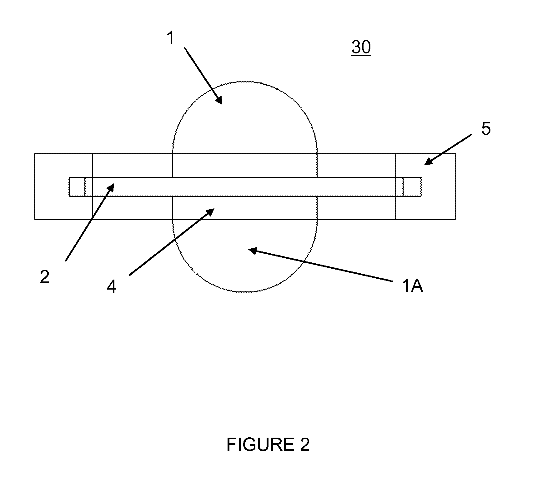 Elastomeric artificial joints and intervertebral prosthesis systems