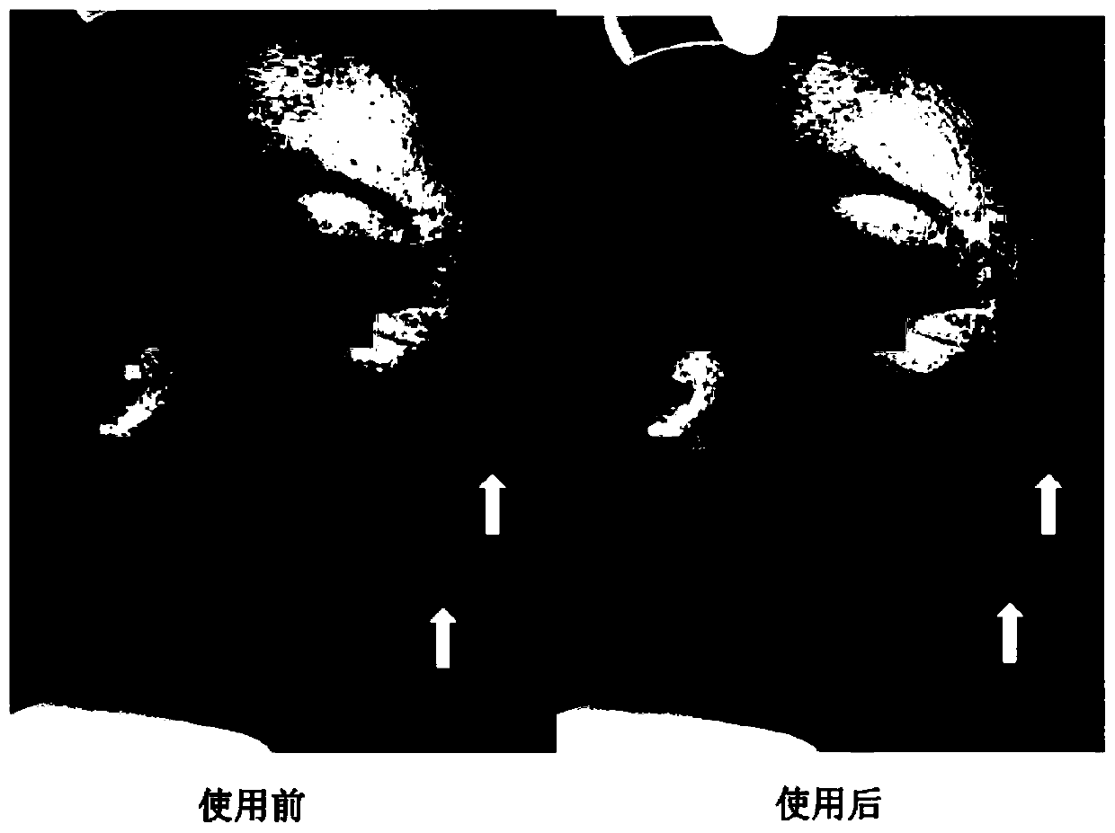 Whitening composition and method for preparing microemulsion type cosmetics