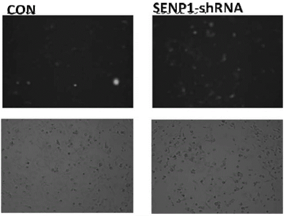 SENP1 protein inhibitor and use thereof