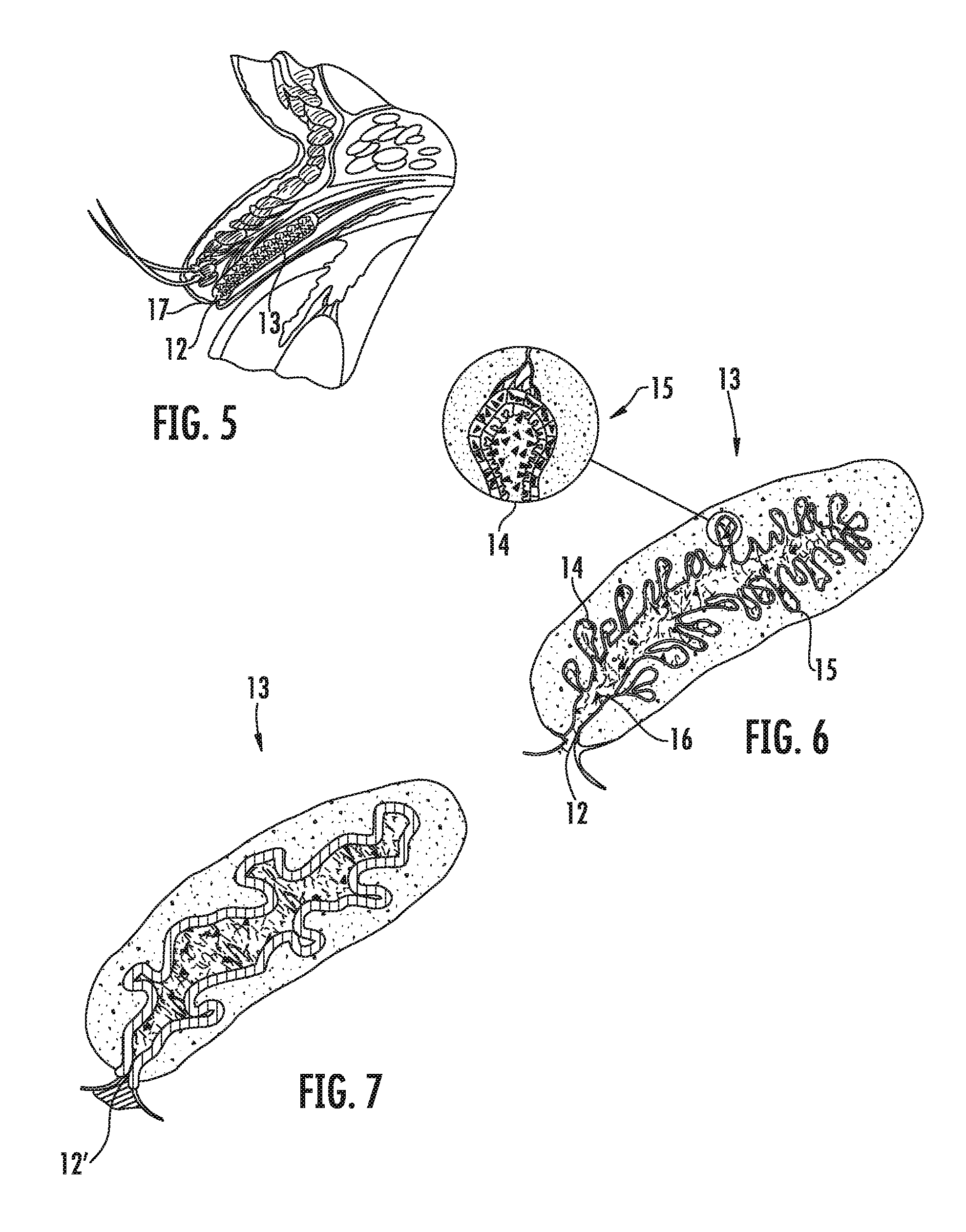 Meibomian Gland Intraductal Diagnostic and Treatment Methods