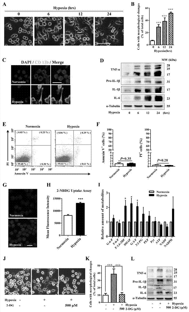 Application of hexokinase 2-specific inhibitor in acute central nervous system injury diseases