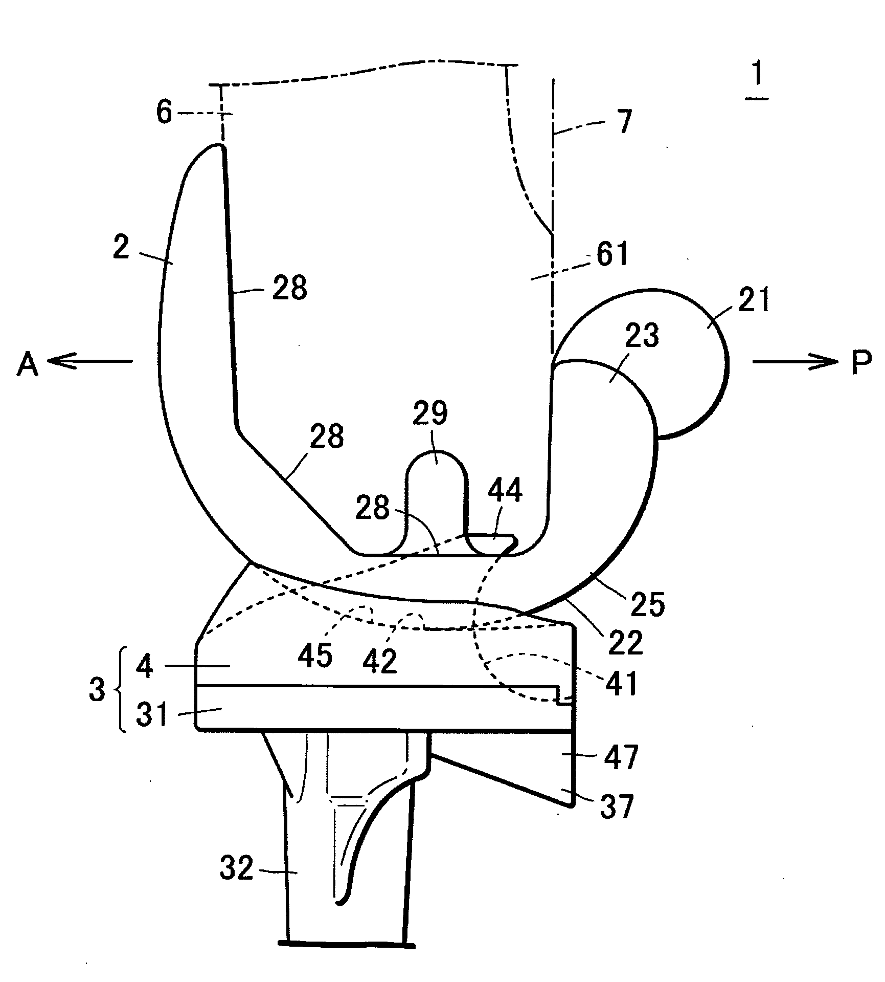 Artificial knee joint