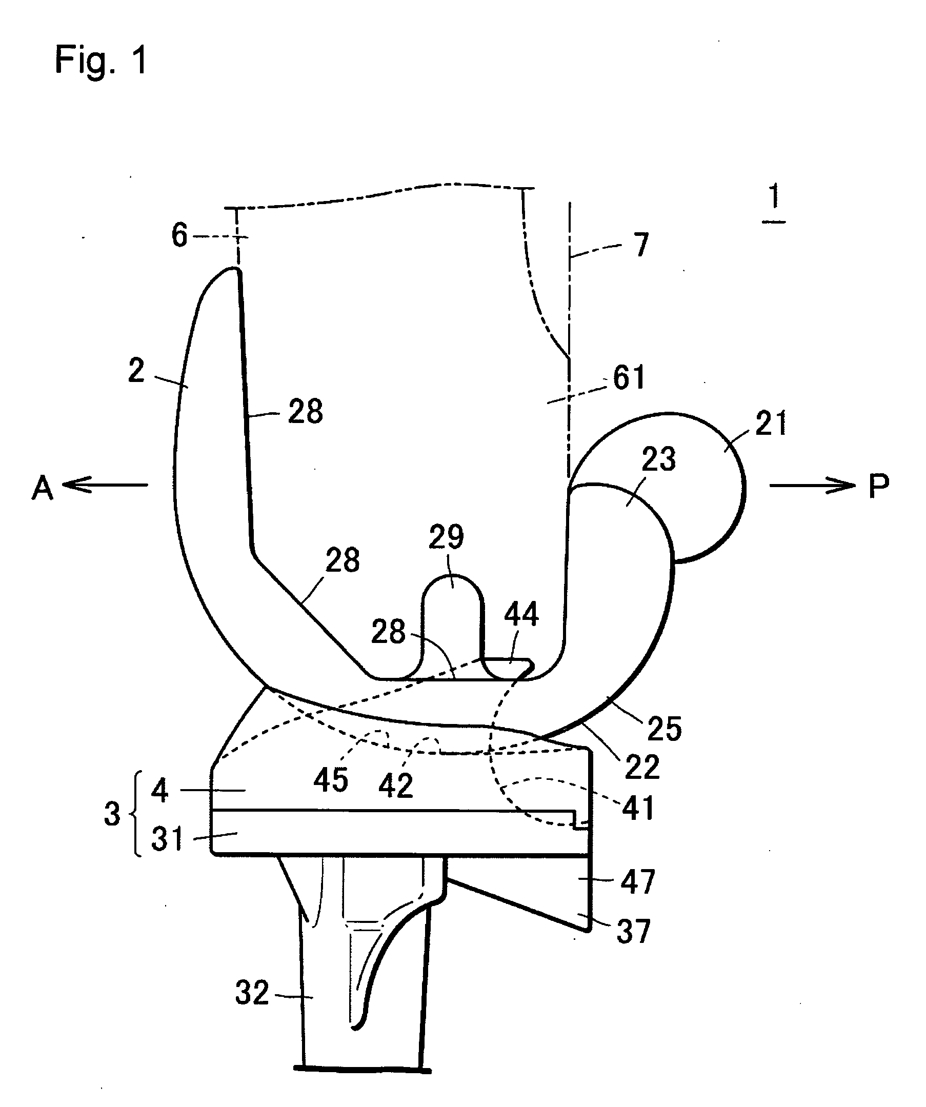 Artificial knee joint