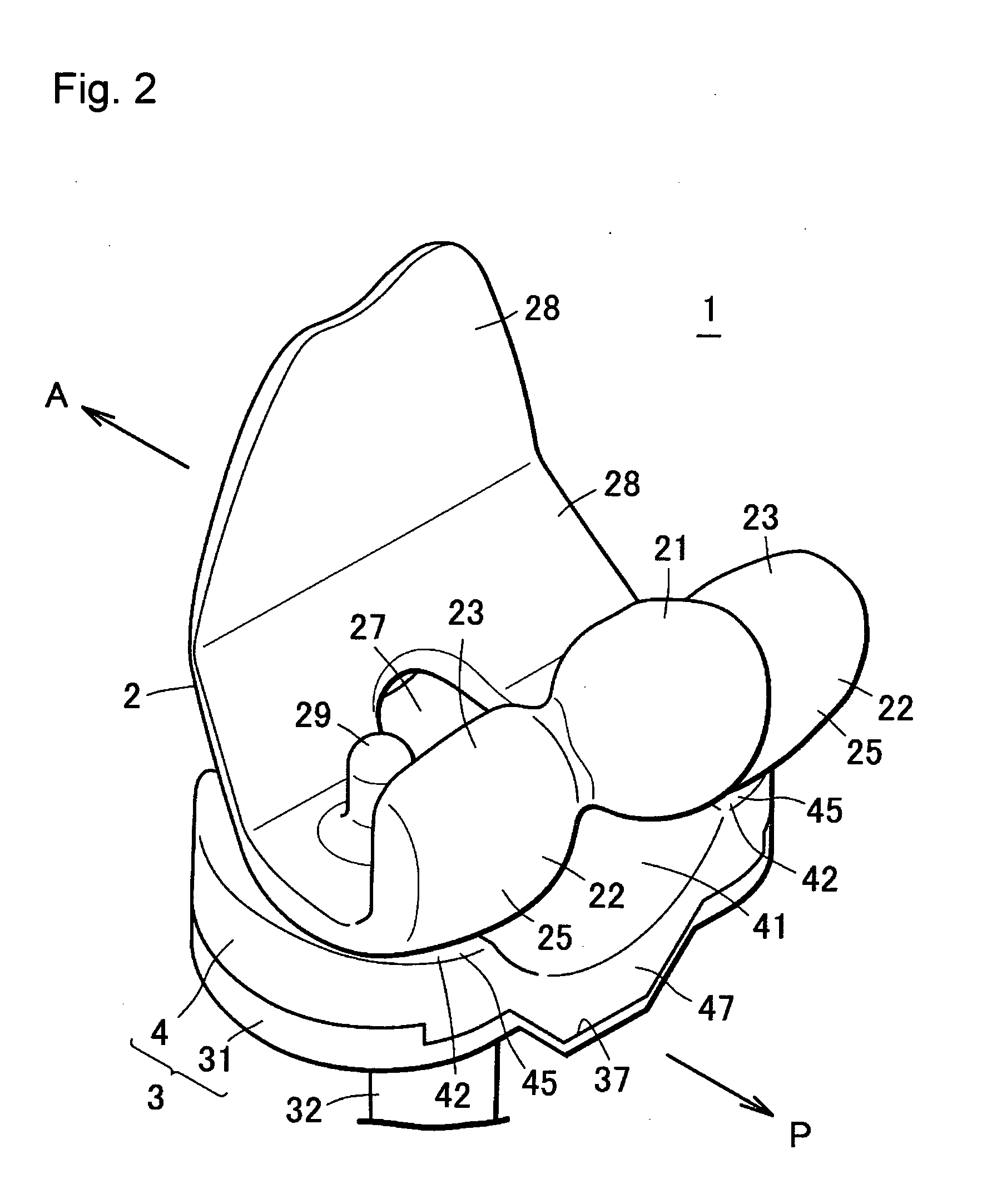 Artificial knee joint