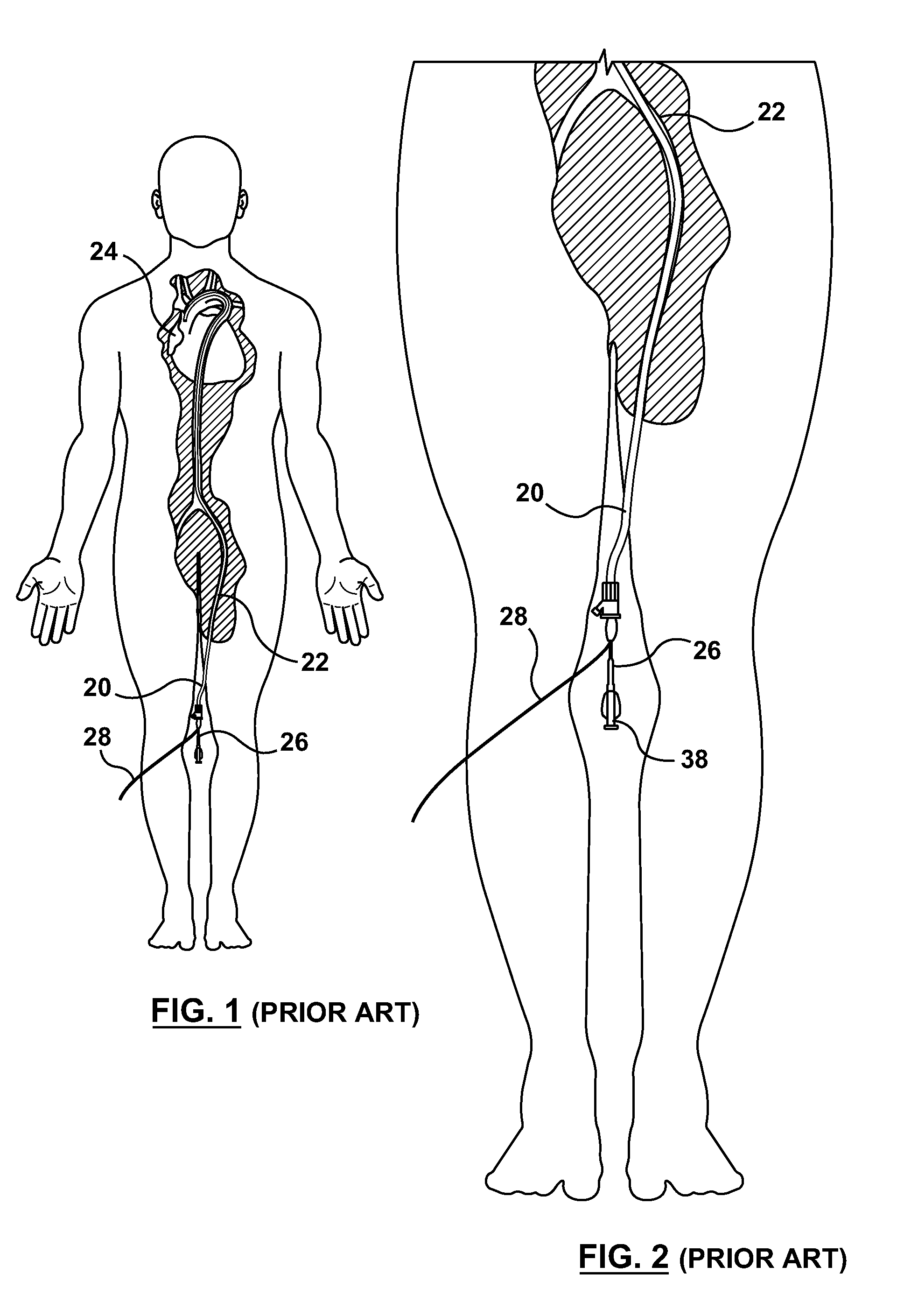 Packaging for a Catheter