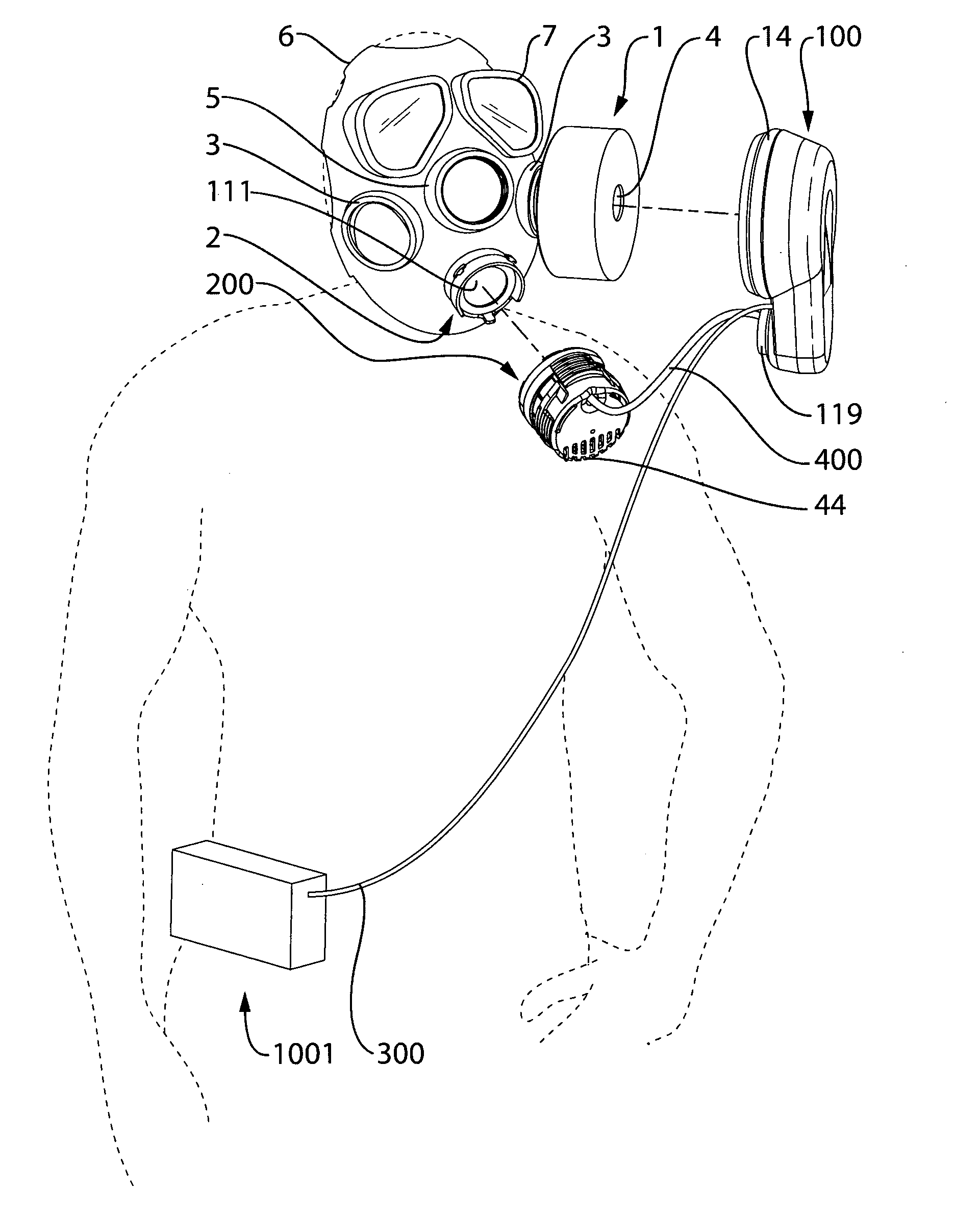 Method and apparatus for ventilation assistance