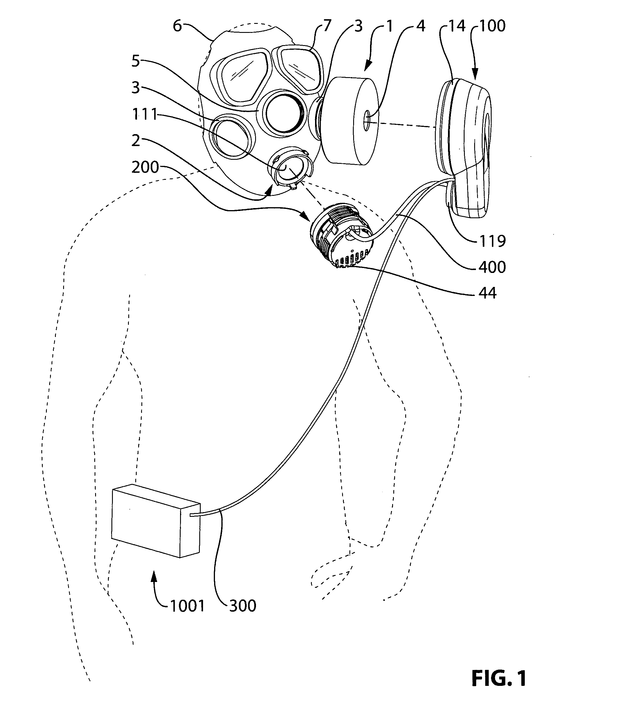 Method and apparatus for ventilation assistance