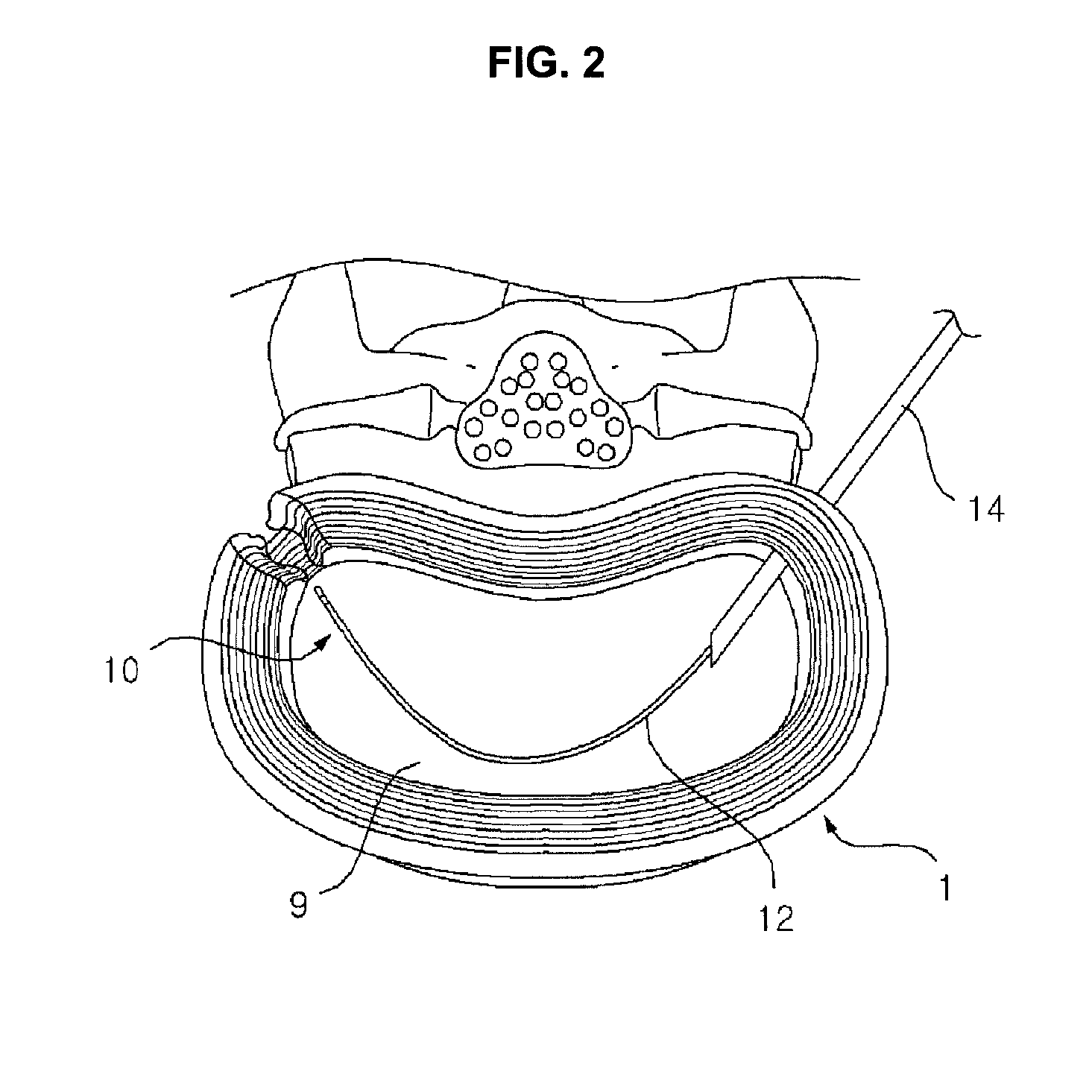 Probe and device for detecting abnormality of intervertebral disc