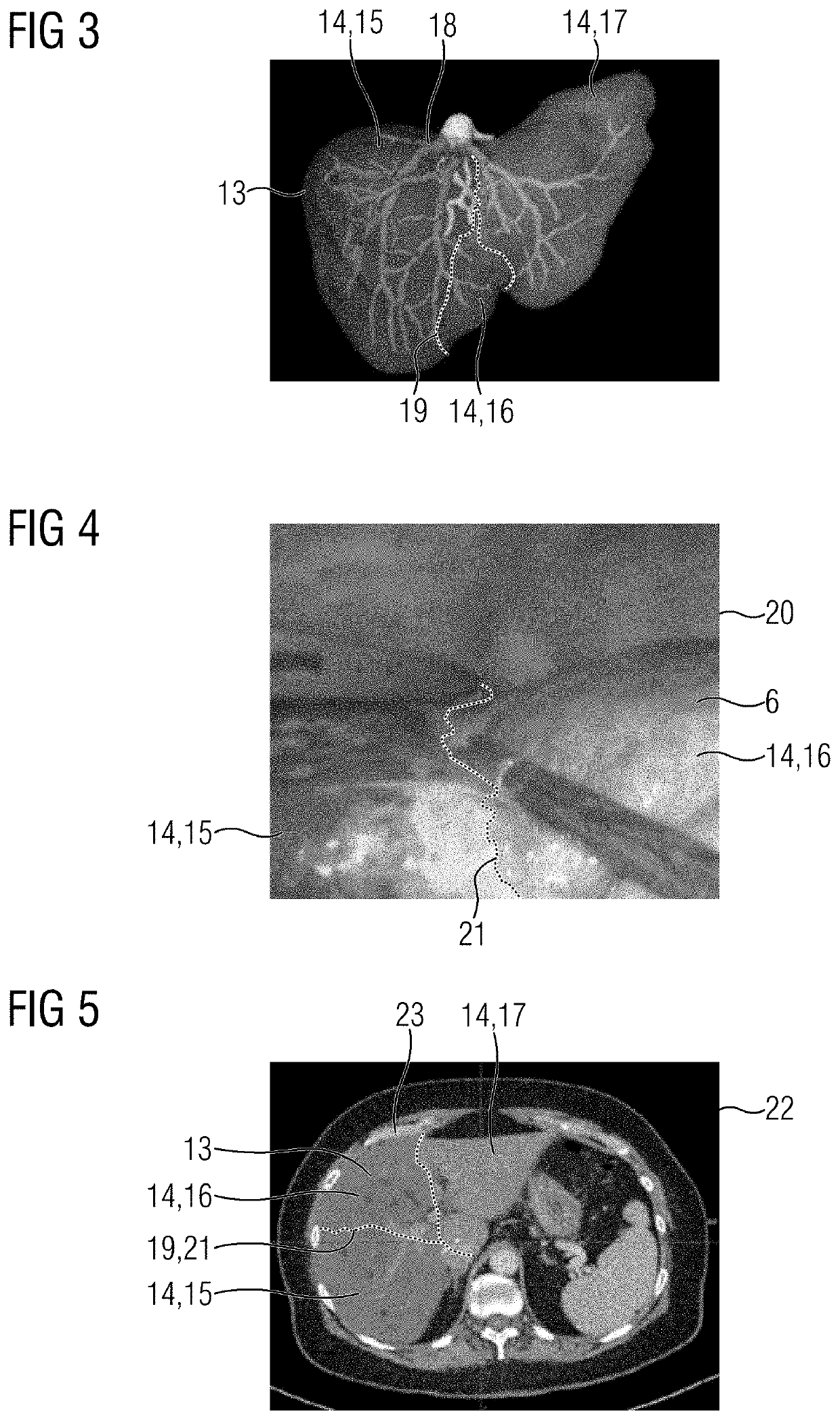 Medical imaging device, method for supporting medical personnel, computer program product, and computer-readable storage medium