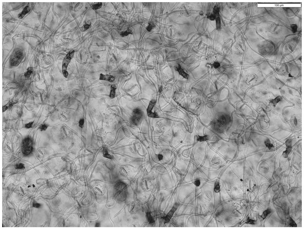 Piece preparation method for simultaneously observing and counting lower glandular hair, non-glandular hair and stomata of folium artemisiae argyi