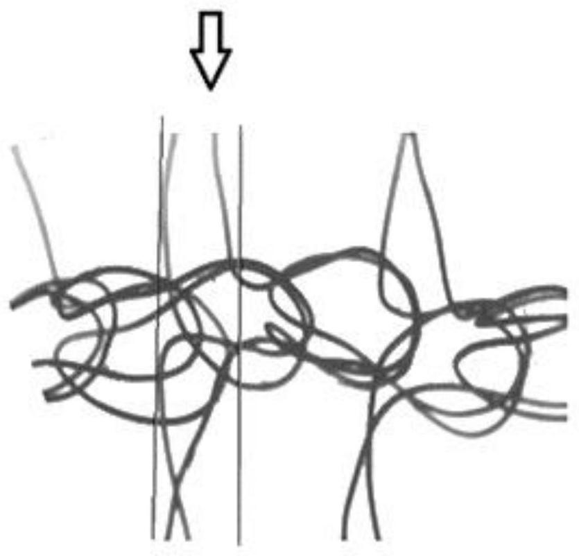 Tension-free titanium metal warp knit fabric for surgically shaping soft tissues