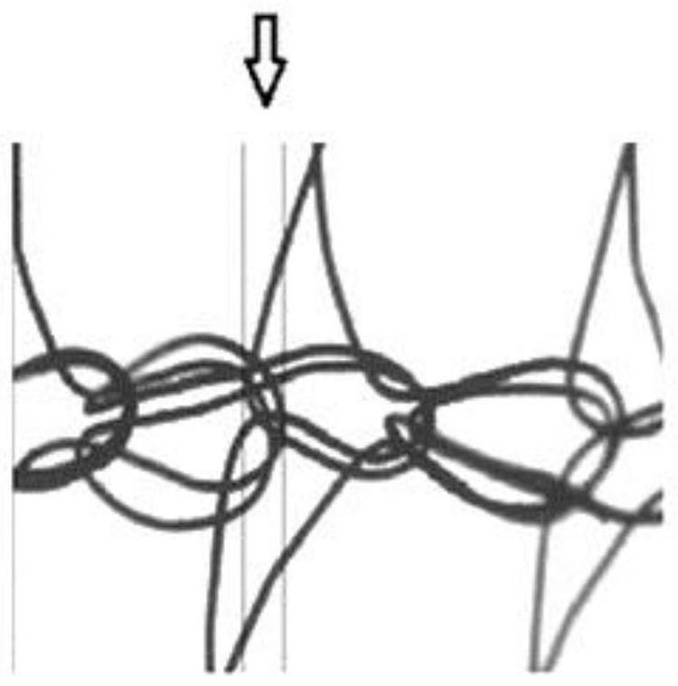 Tension-free titanium metal warp knit fabric for surgically shaping soft tissues