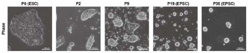 Special culture medium for converting human pluripotent stem cells into extended pluripotent stem cells, and application of special culture medium