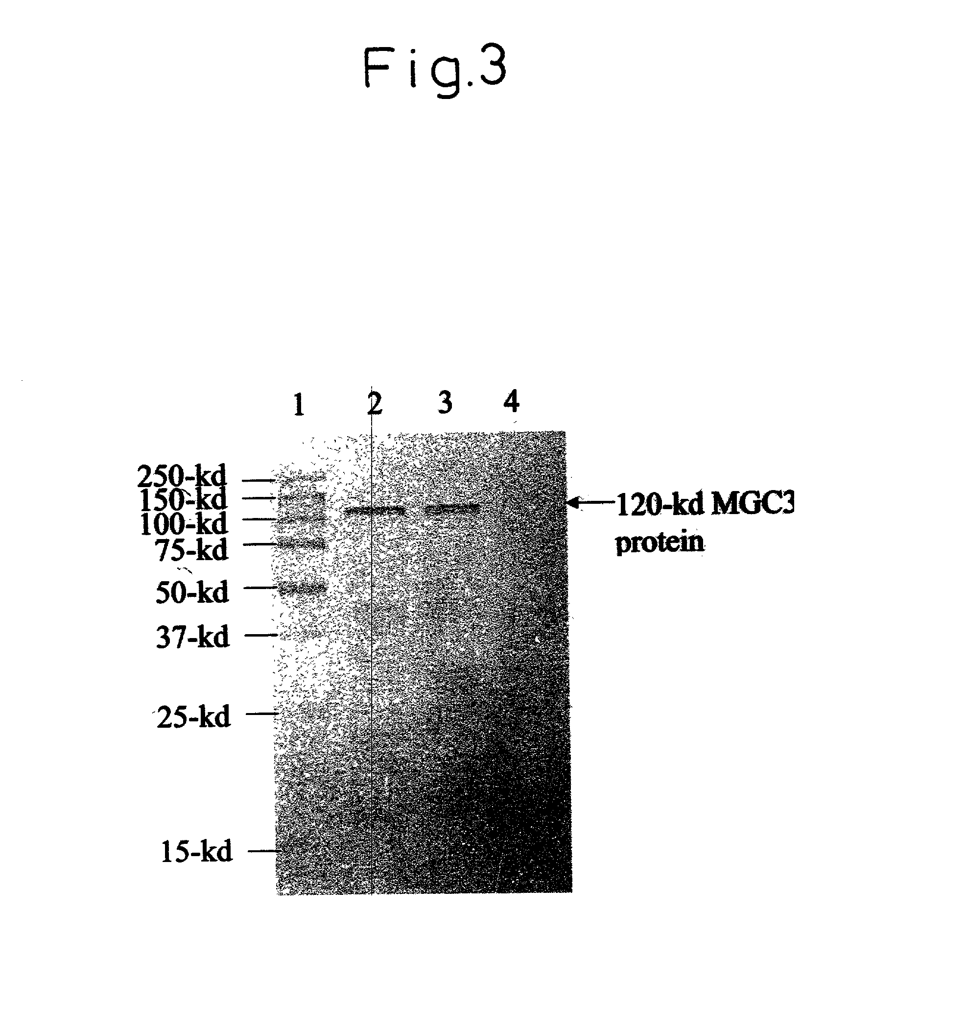 Modified DNA molecule, recombinant containing the same, and uses thereof