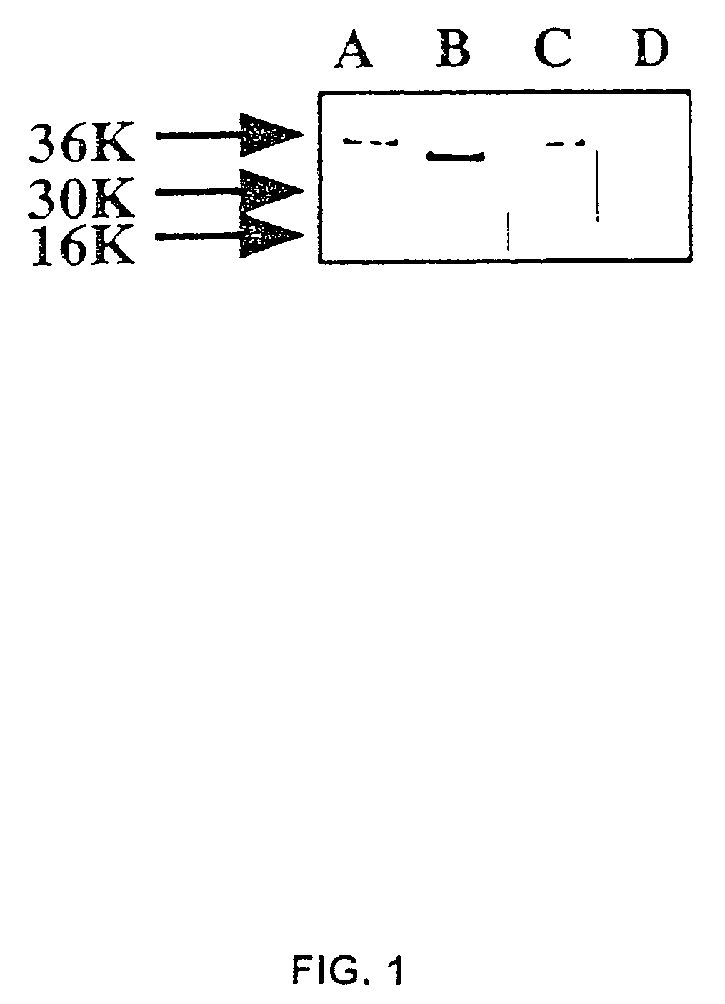 Substance P-saporin (SP-SAP) conjugates and methods of use thereof